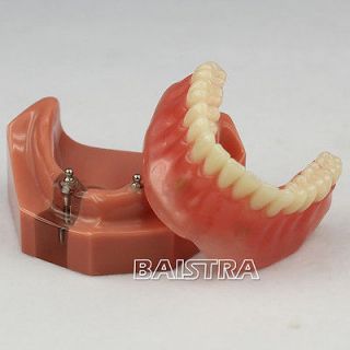 NEW Dental Study Teaching Model Teeth Implant Repair Model # 6007