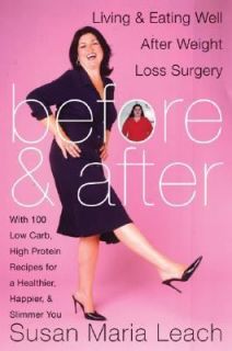   after Weight Loss Surgery by Susan Maria Leach 2004, Hardcover