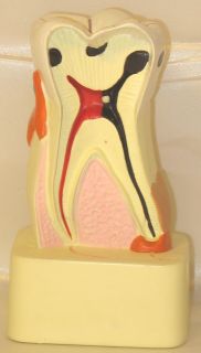 Caries Cavity Tooth Teeth Dental Anatomical Model New