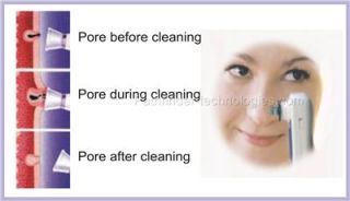 Green Pore Cleaner Blackheads Remover Oily Skin Exfoliator HELPS 
