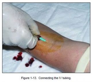 Haematology Immunohematology Blood Banking Intravenous