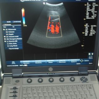 GE Logiq E Portable Ultrasound