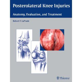 Image Posterolateral Knee Injuries Anatomy, Evaluation, and